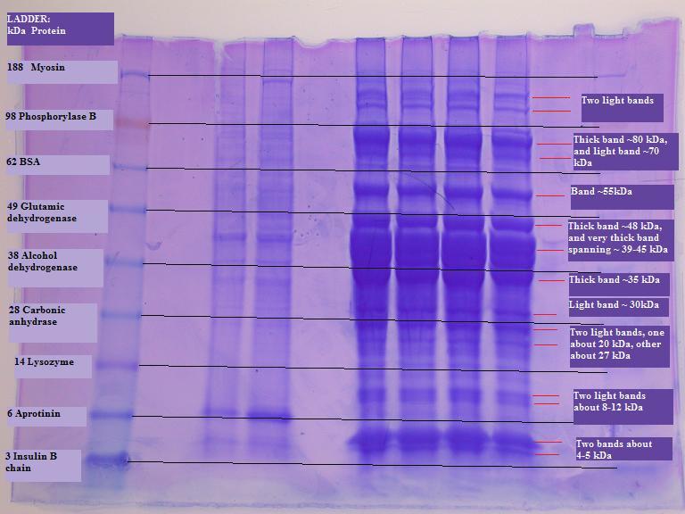 Protein_Gel_Back_Bob_Jenn_011409_with_ladder_markings.jpg