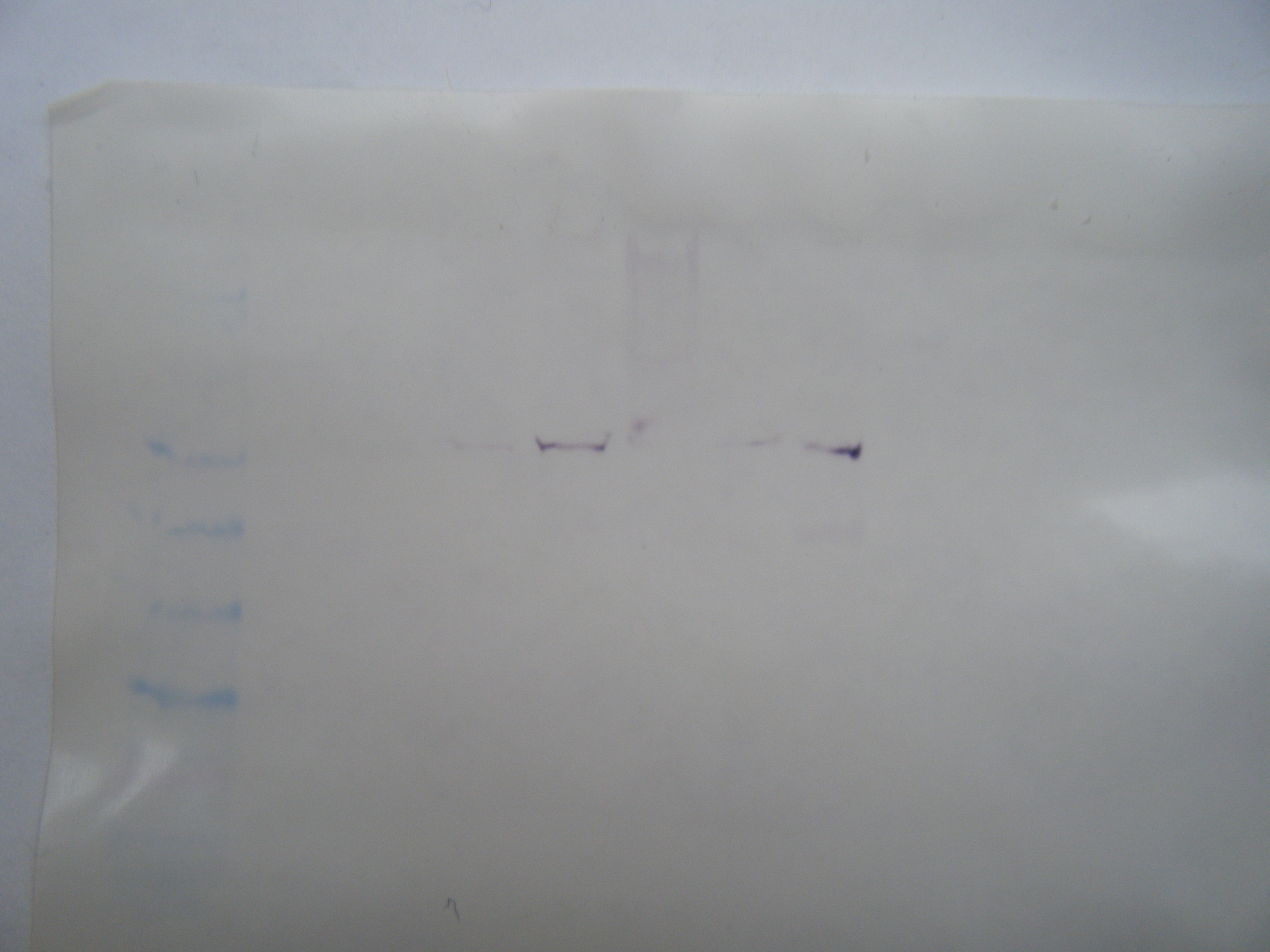 western_blot